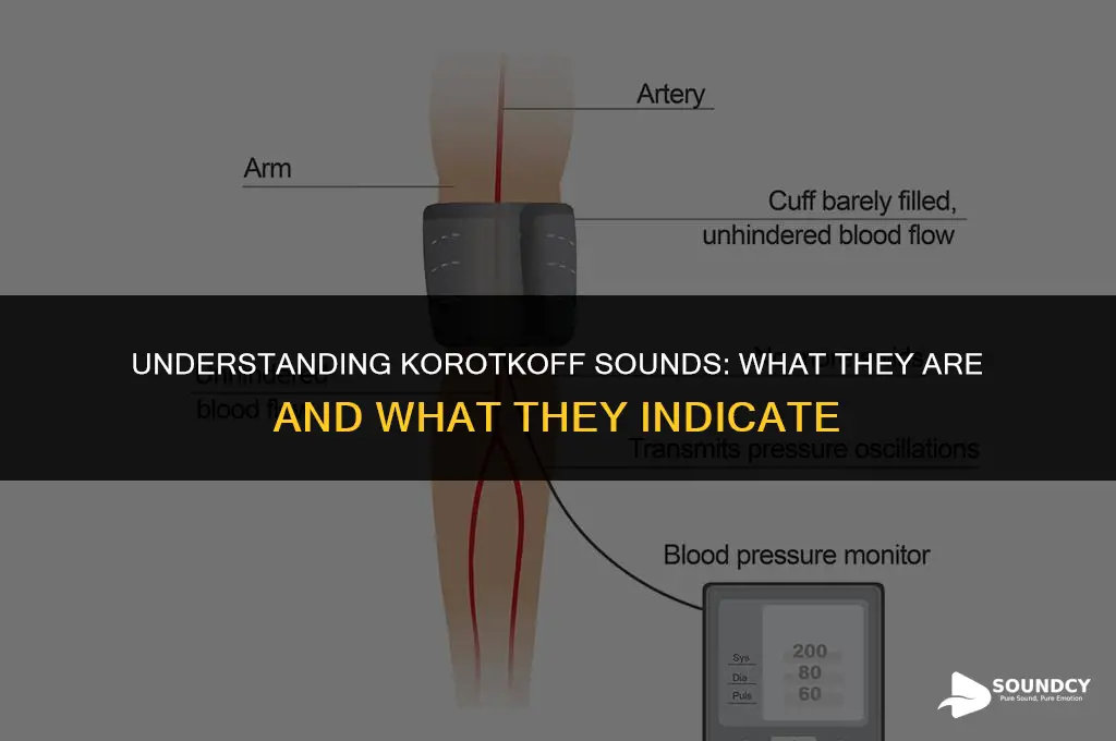 what are korotkoff sounds and what do they represent