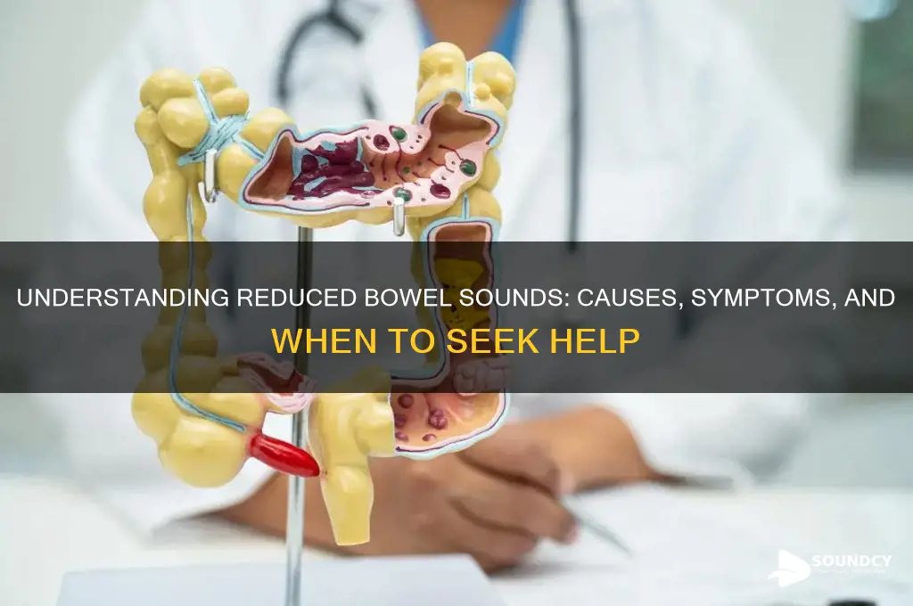 what are reduced bowel sounds