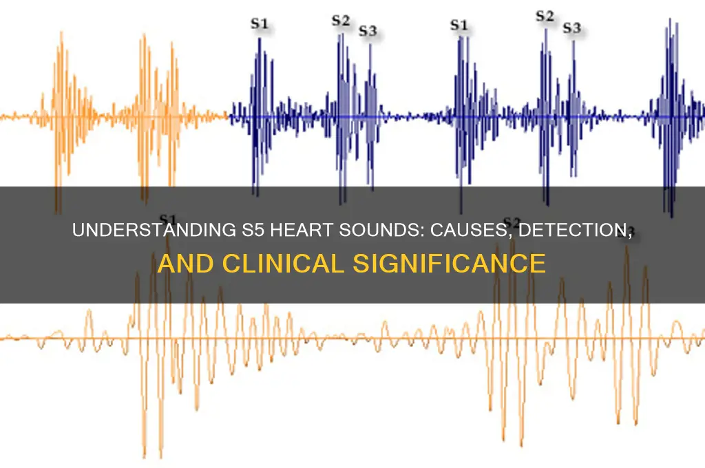 what are s5 heart sounds