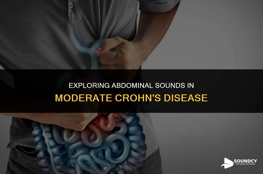 what are some abdominal sounds associated with moiderate chrons