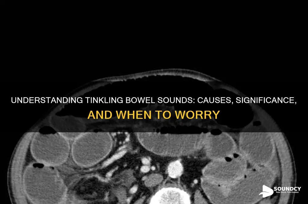 what are tinkling bowel sounds