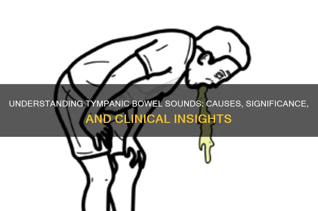 what are tympanic bowel sounds