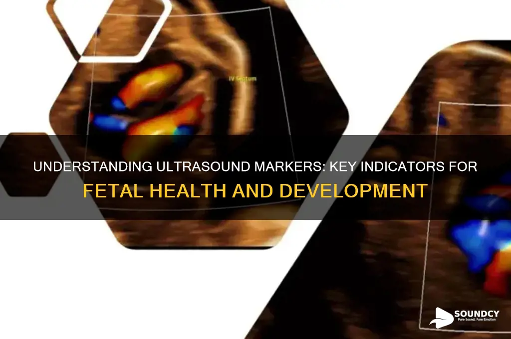 what are ultra sound markers