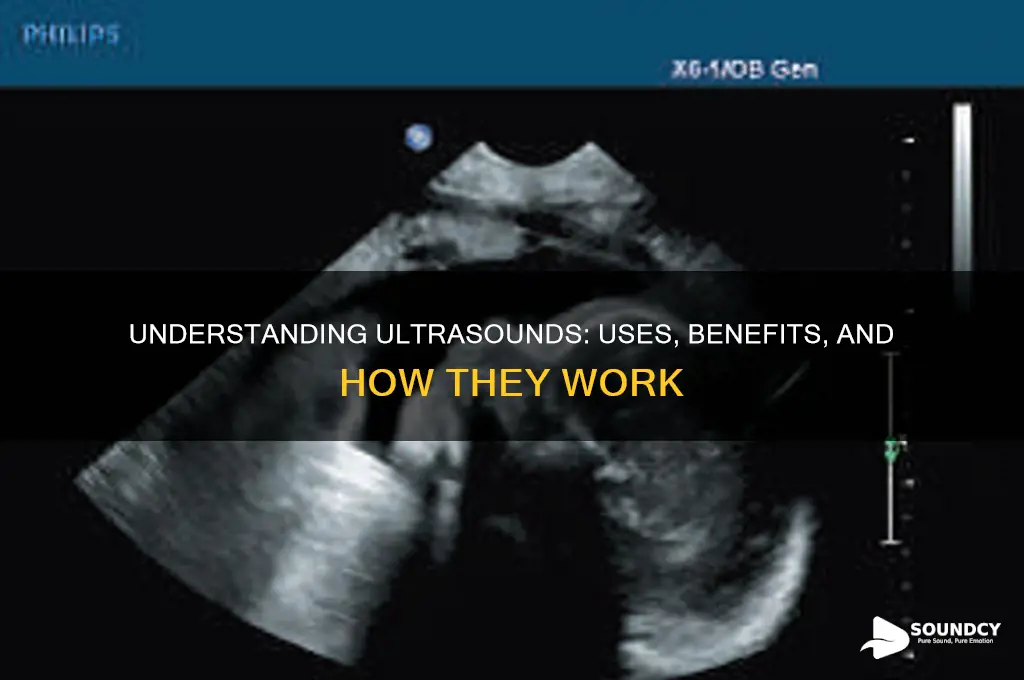 what are ultra sounds for