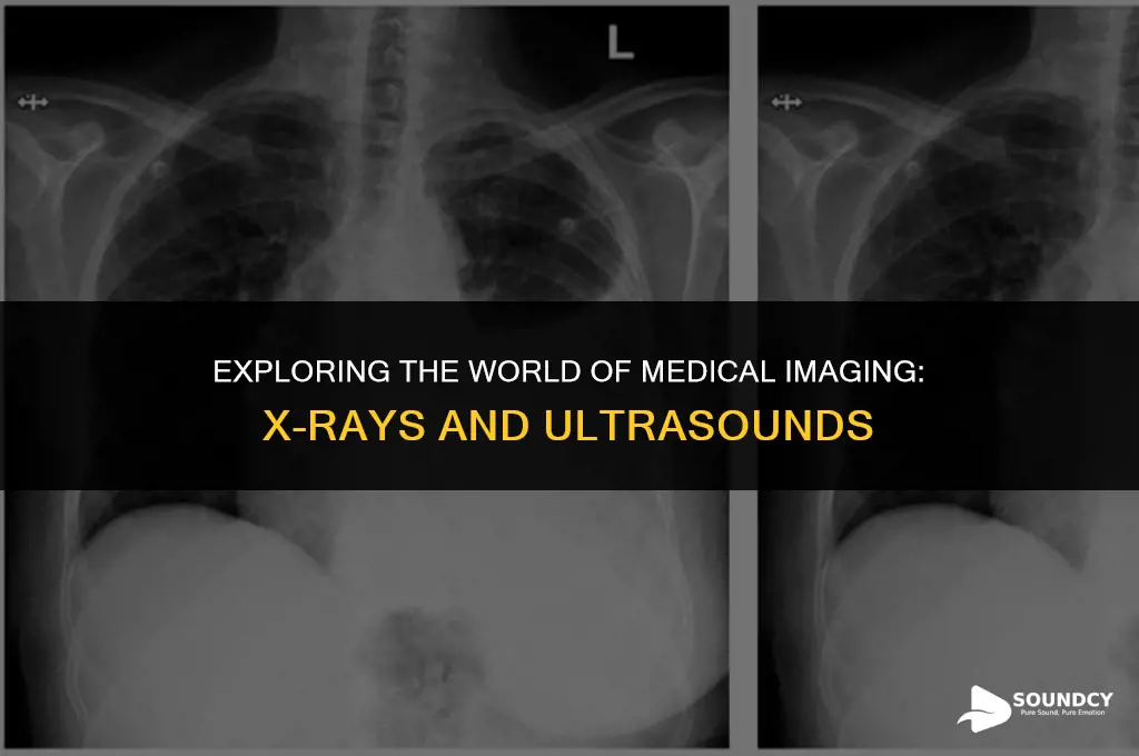 what are x ray and ultra sounds categoruzed under