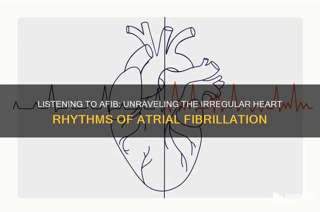 what atrial fibrillation sounds like