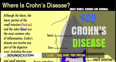 Understanding Normal Bowel Sounds in Crohn's Disease