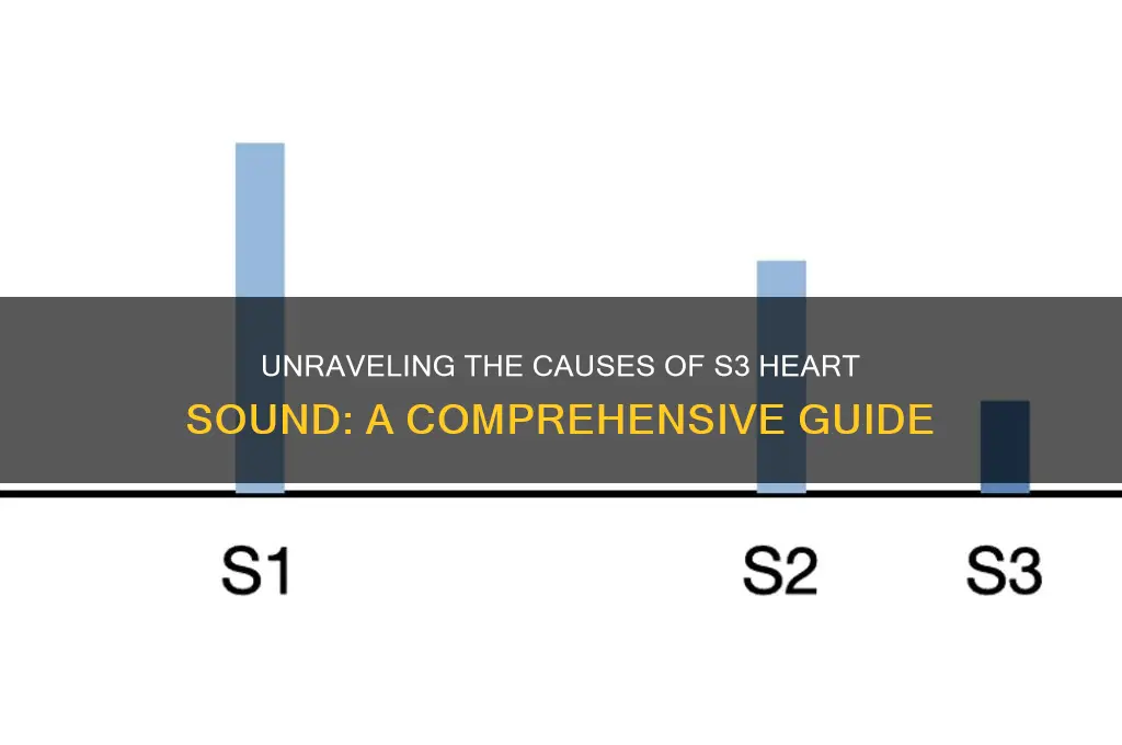 what cause s3 heart sound