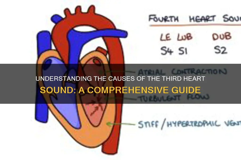 what causes 3rd heart sound