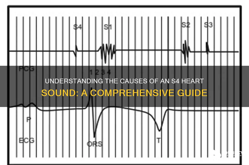 what causes an s4 sound