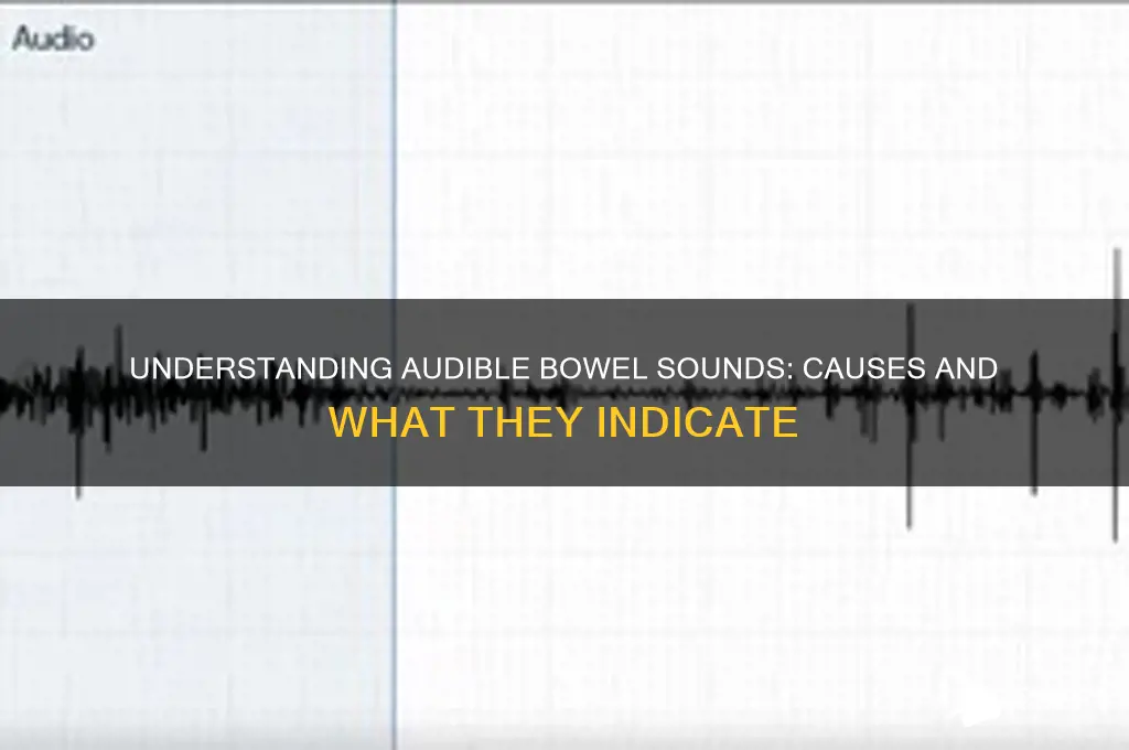 what causes audible bowel sounds