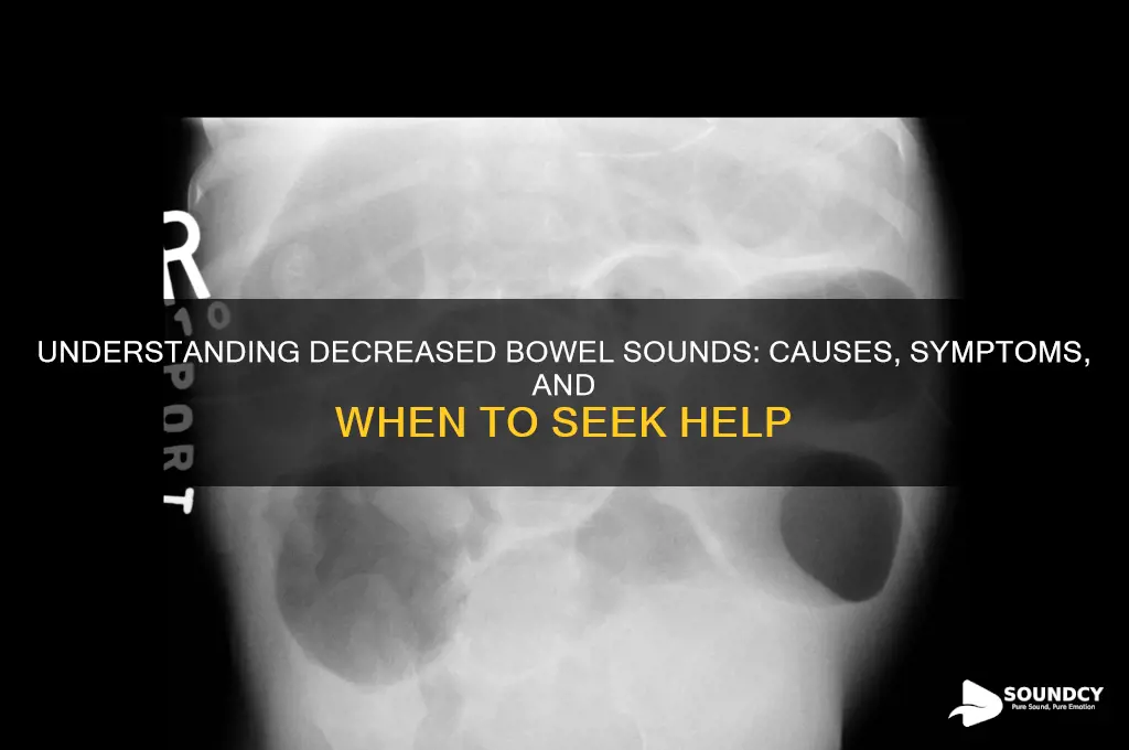 what causes decreased bowel sounds