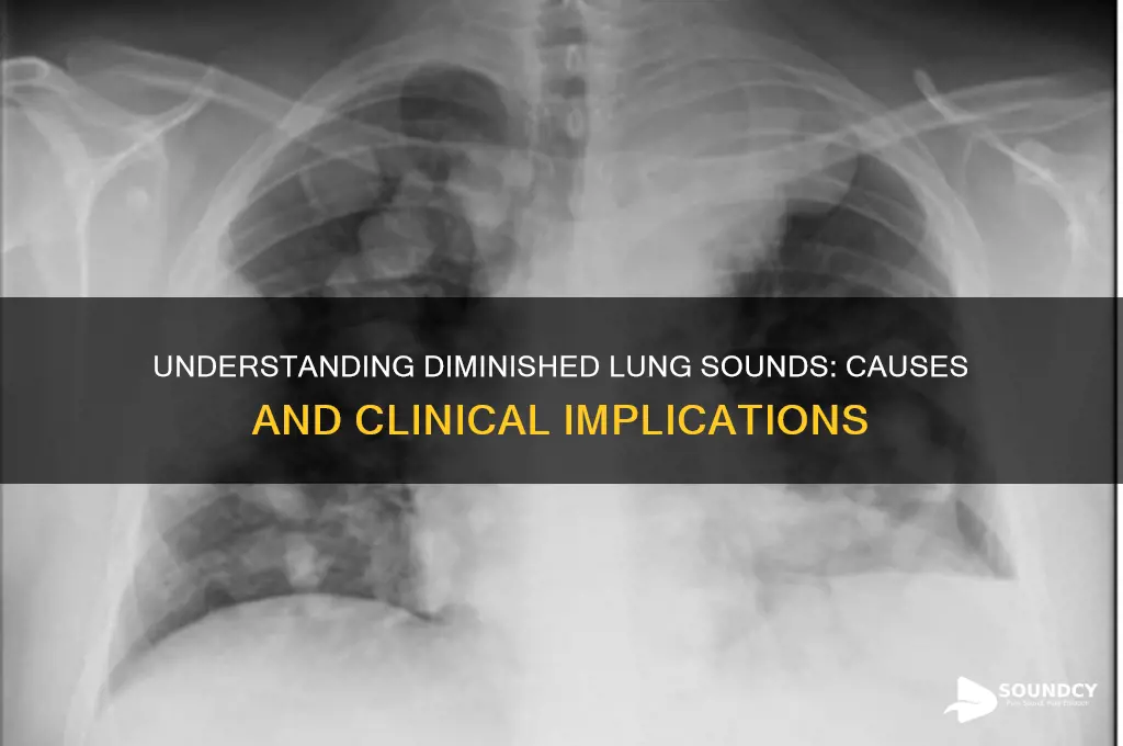 what causes diminished lung sounds