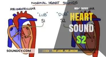 Understanding Heart Sound S2: Causes and Mechanisms Explained