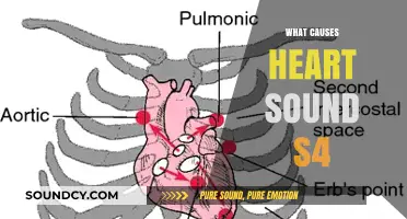 Understanding the Causes of Heart Sound S4: A Comprehensive Guide