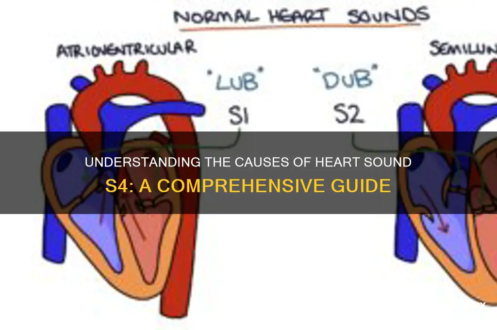 what causes heart sound s4