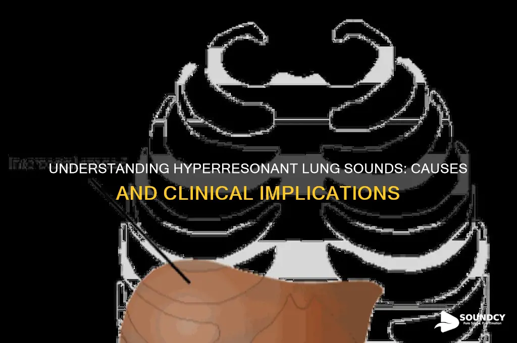 what causes hyperresonant lung sounds