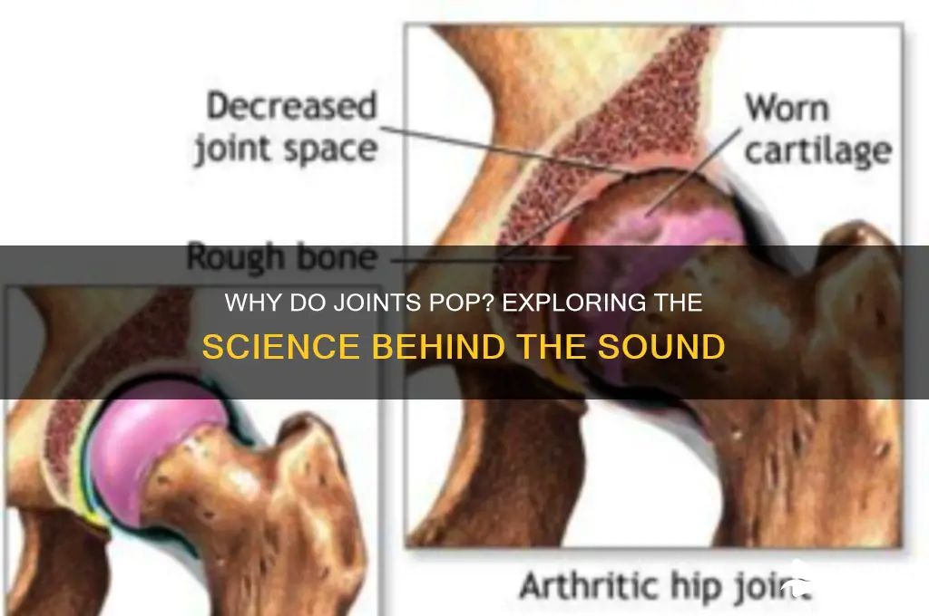 what causes joint popping sound