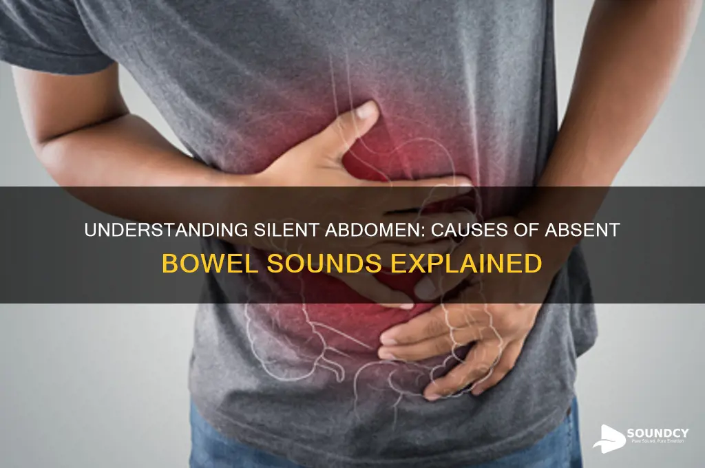 what causes no bowel sounds
