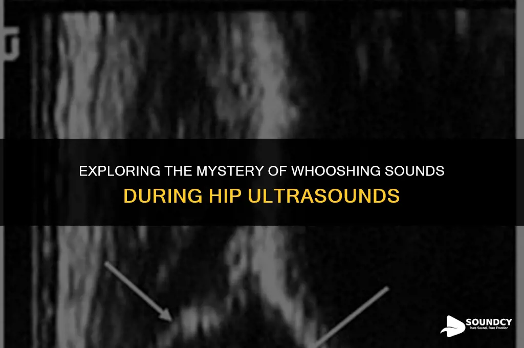 what causes occasional whooshing sound during ultrasound on hip
