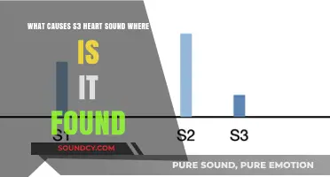 Understanding S3 Heart Sound: Causes and Locations Explained