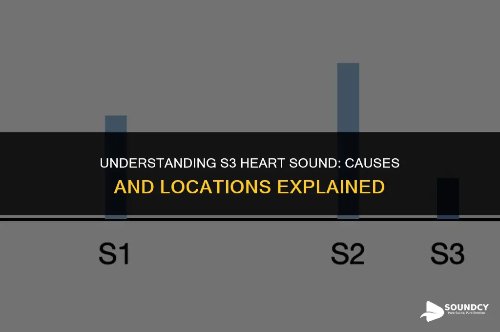 what causes s3 heart sound where is it found