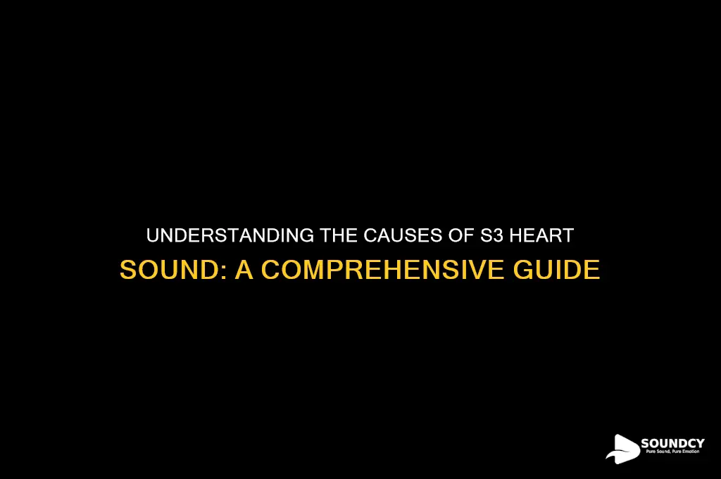 what causes s3 heart sound
