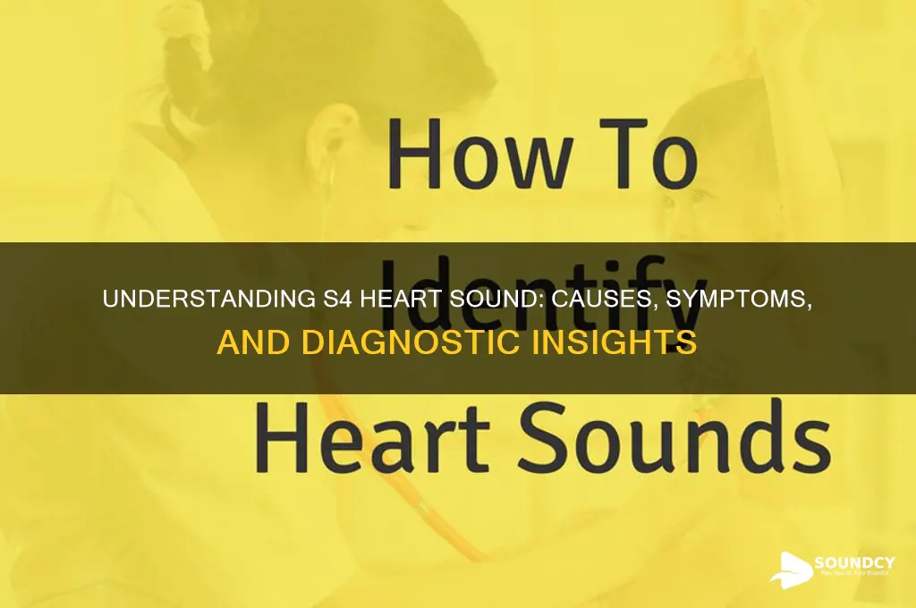what causes s4 heart sound