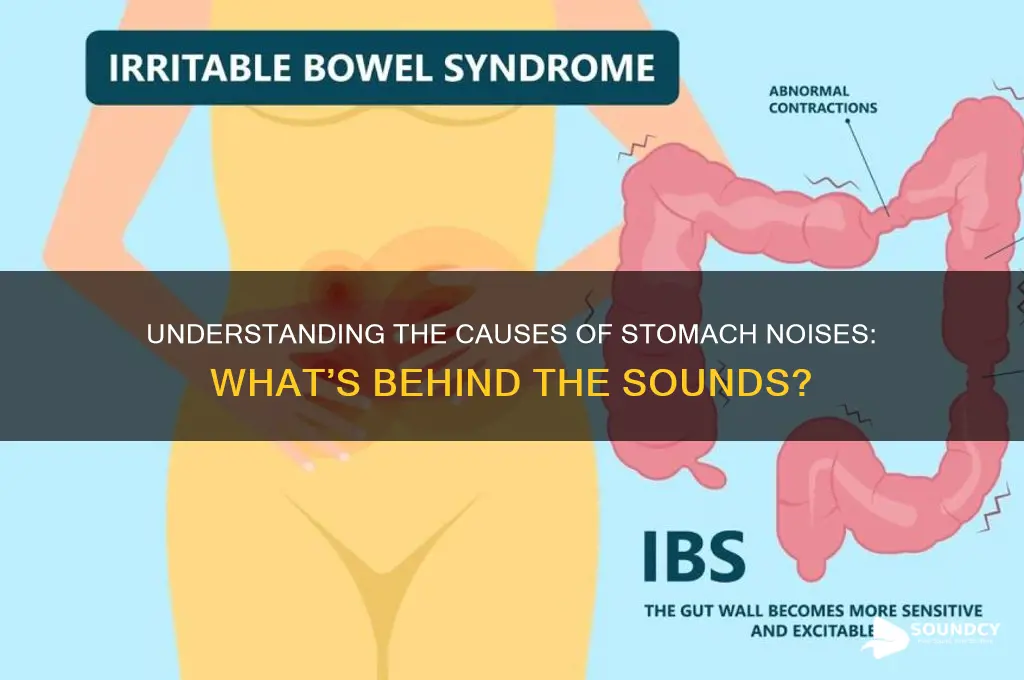 what causes sound in stomach