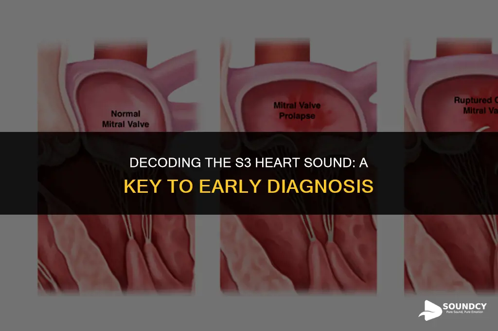 what diagnosis is the s3 heart sound pathognomonic for