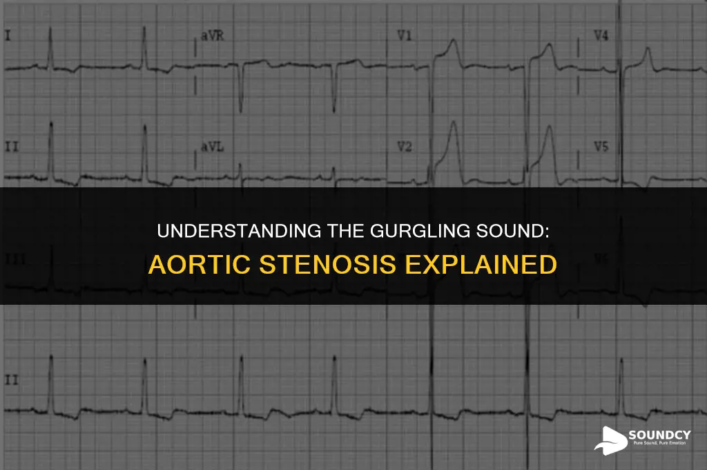 what disorder of the heart has a gurgling sound