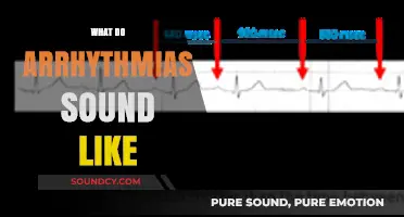 Unraveling Arrhythmia Sounds: What Abnormal Heartbeats Actually Sound Like