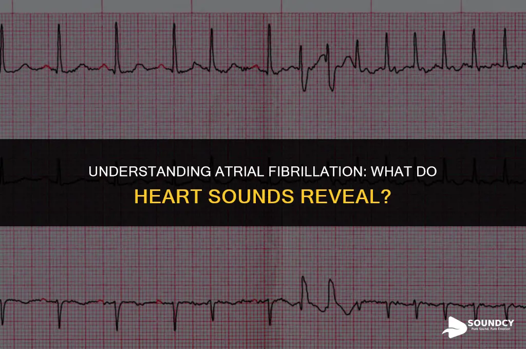 what do heart sounds sound like when in afib