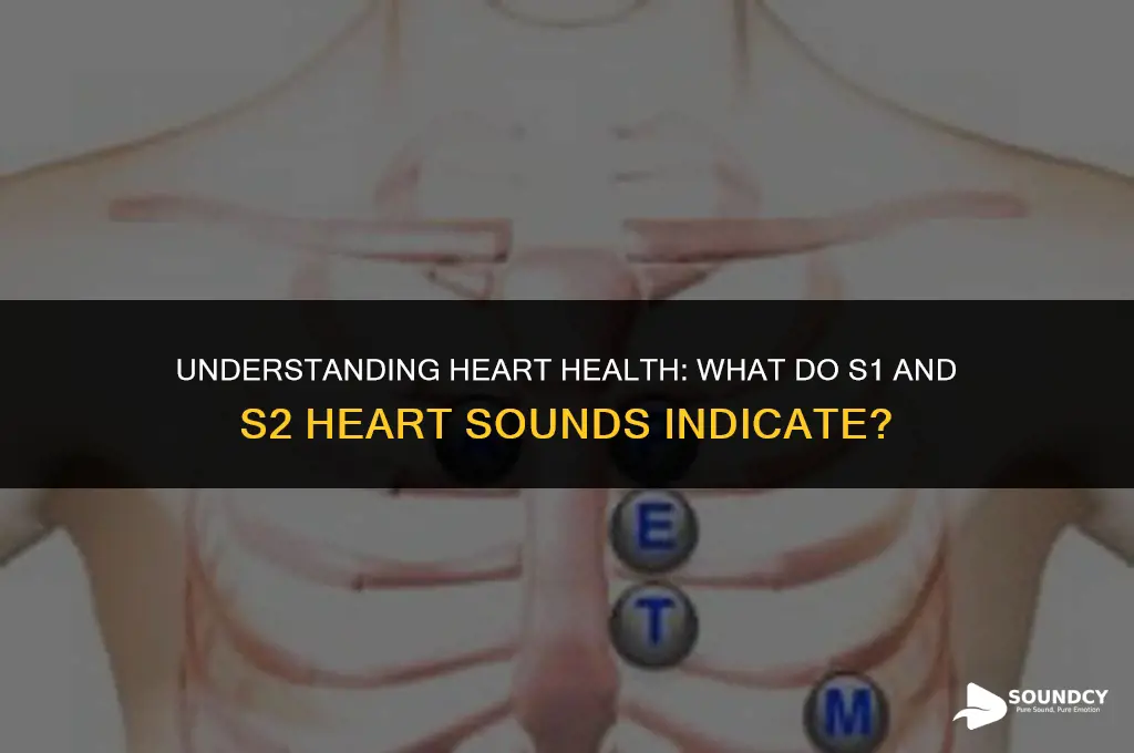 what do s1 and s2 heart sounds sound like