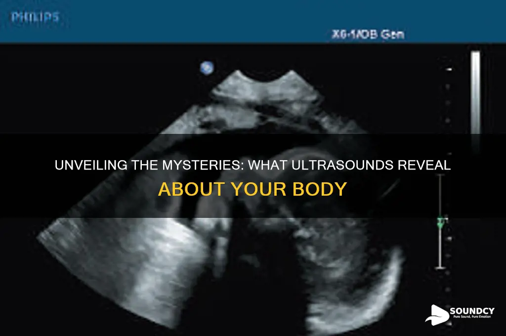 what do ultra sounds see