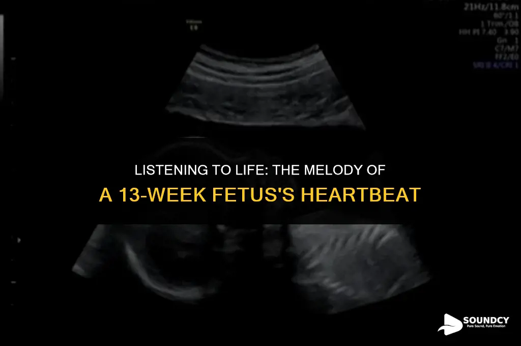 what does a 13 week fetus heartbeat sound like