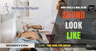Exploring the Wonders: A Glimpse into 5-Week Ultrasound Imagery