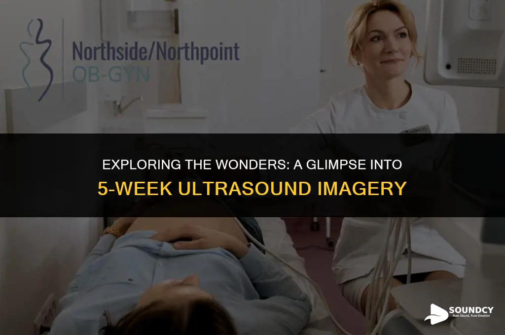 what does a 5 weel ultra sound look like