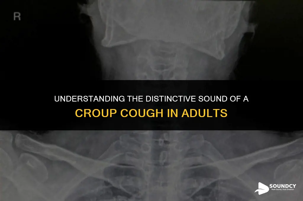 what does a croup cough sound like in adults