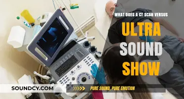 Unveiling the Differences: CT Scans vs. Ultrasounds in Medical Imaging