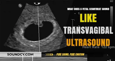 Exploring the Miracle: Fetal Heartbeat on Transvaginal Ultrasound