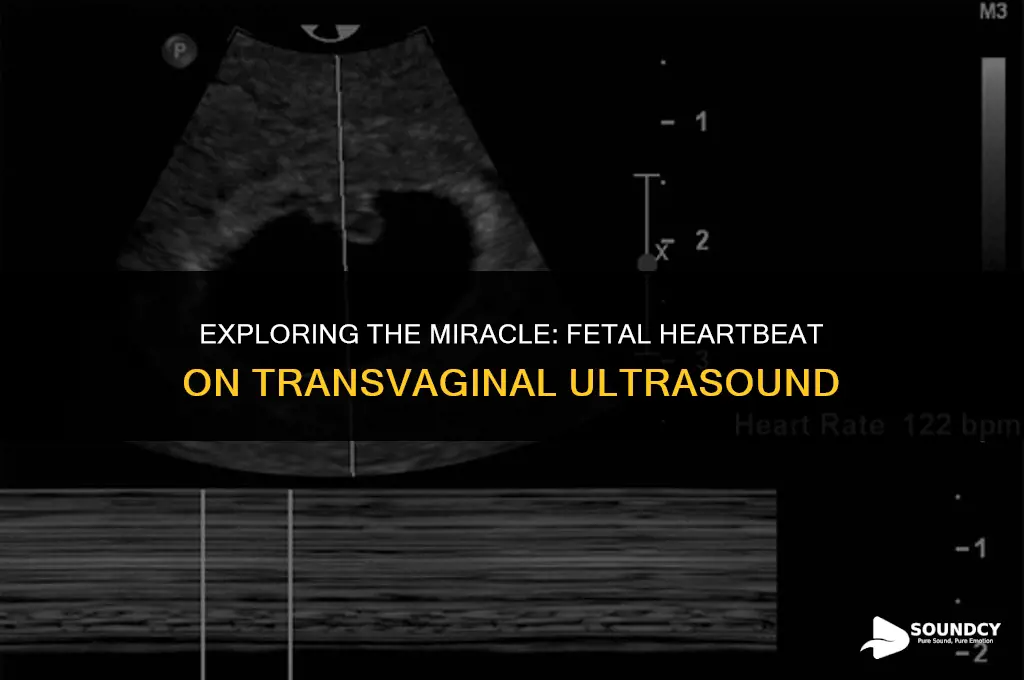 what does a fetal geartbeat sound like transvagibal ultrasound