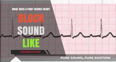 Understanding First Degree Heart Block: Recognizing the Rhythm