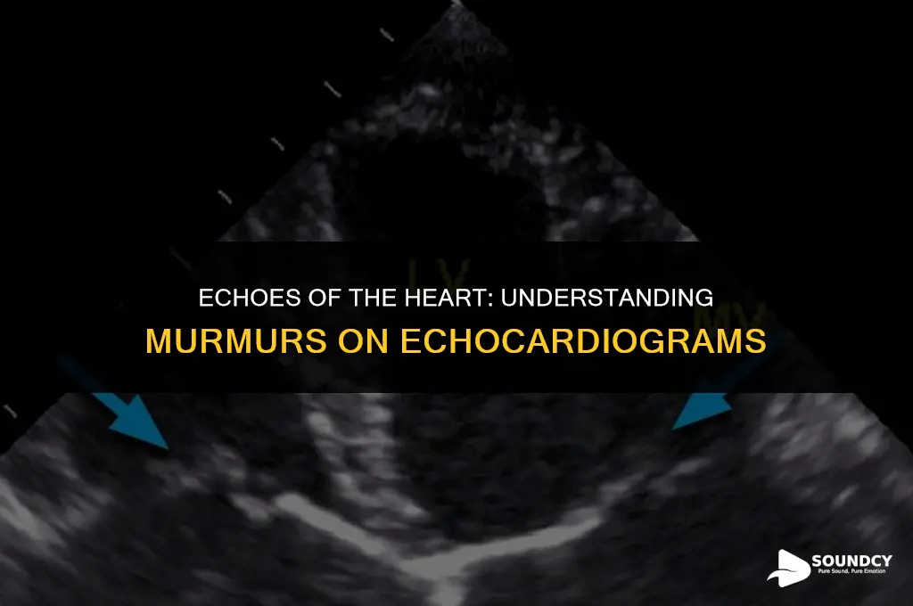 what does a heart murmur sound like on echocardiogram