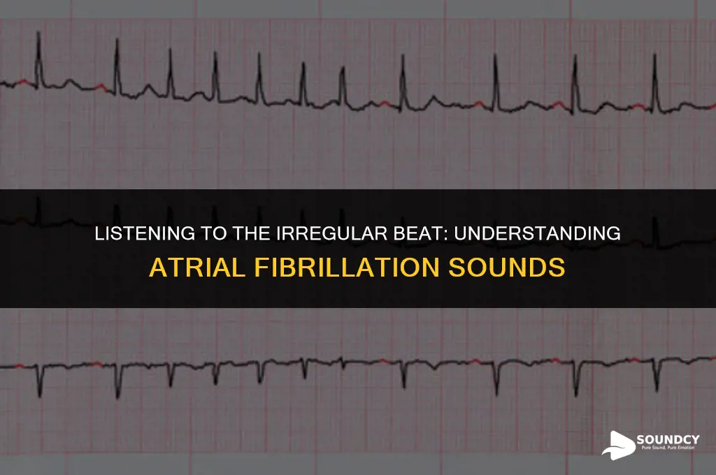 what does a heart with atrial fibrillation sound like