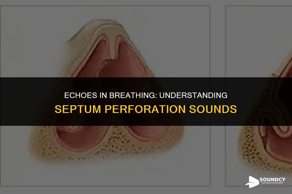what does a hole in your septum sound like