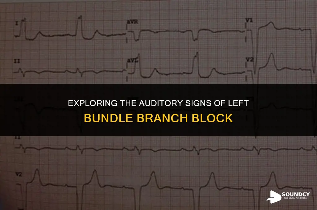 what does a left bundle branch block sound like