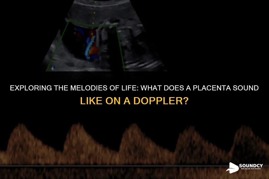 what does a placenta sound like on a doppler