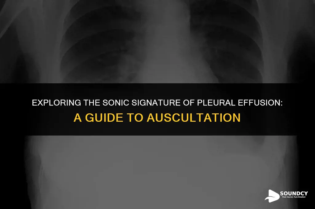 what does a pleural effusion sound like on auscultation