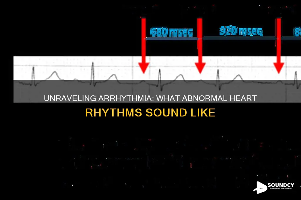 what does arrhythmia sound like